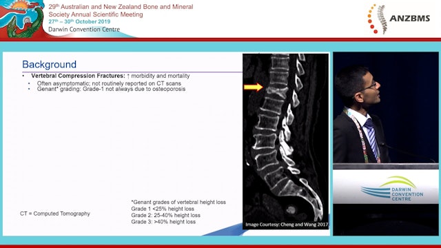 Utility of image analytic computer-assisted detection of vertebral fracture Nithin Kolanu