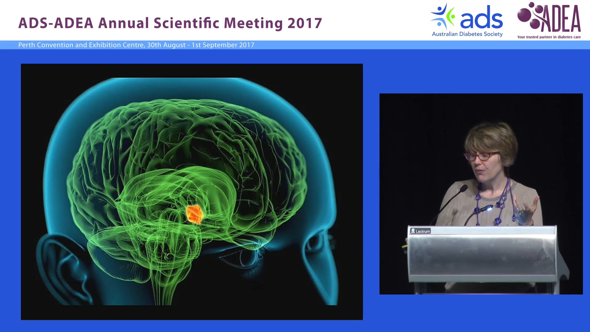 Optimizing weight loss outcomes by manipulating the level, duration and frequency of energy restriction Assoc Prof Amanda Salis