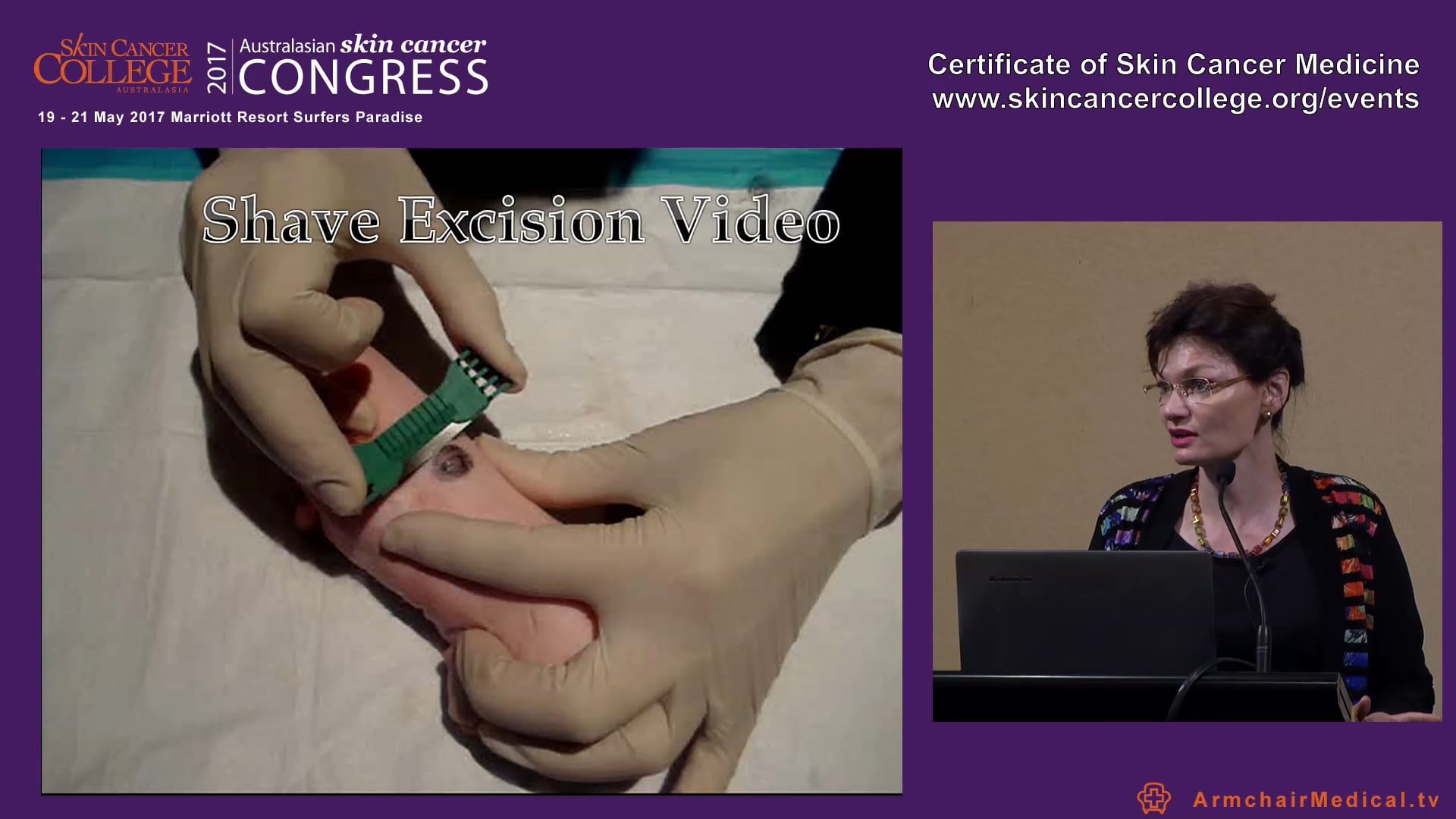 Skin Cancer Practice Pearls 11 - 12