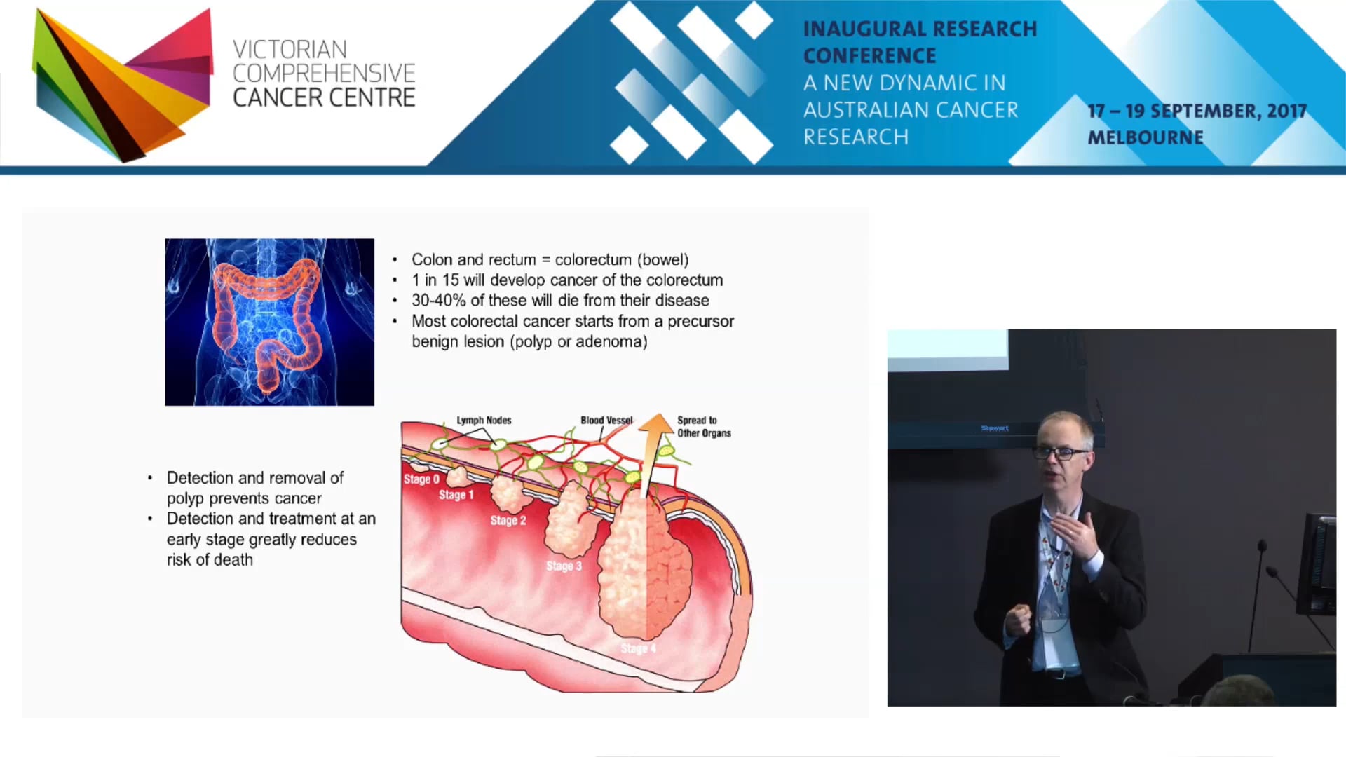 The use of personalized DNA testing to guide screening for colorectal cancer - Mark Jenkins