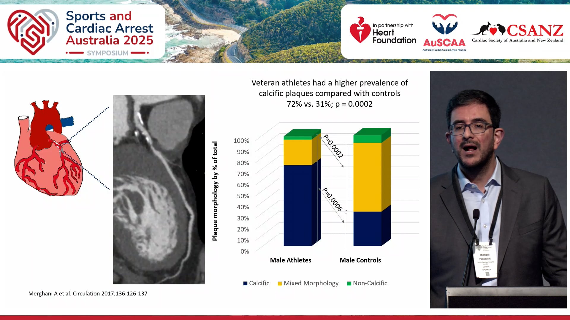 Coronary artery disease in the athlete Prof Michael Papadakis (St George’s London UK)