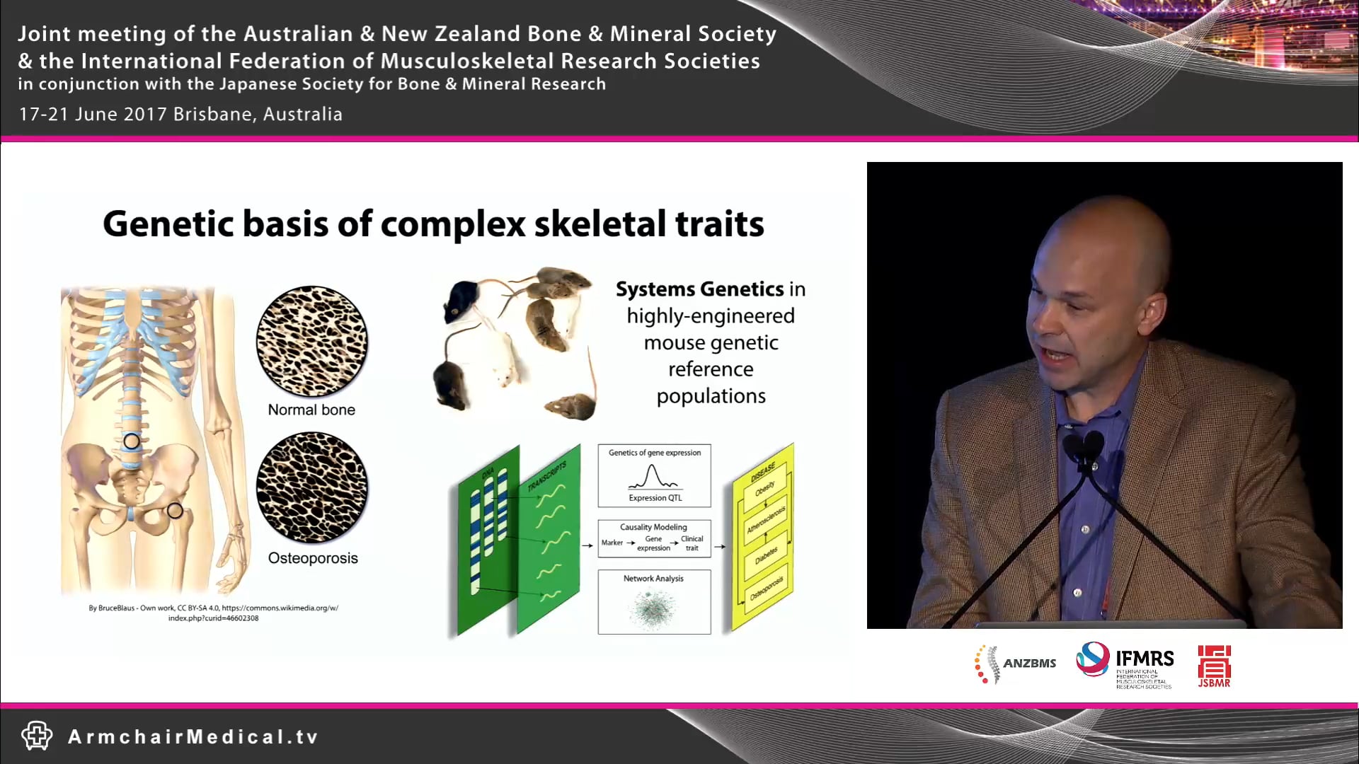 Informing GWAS using systems genetics Assoc Prof Charles Farber