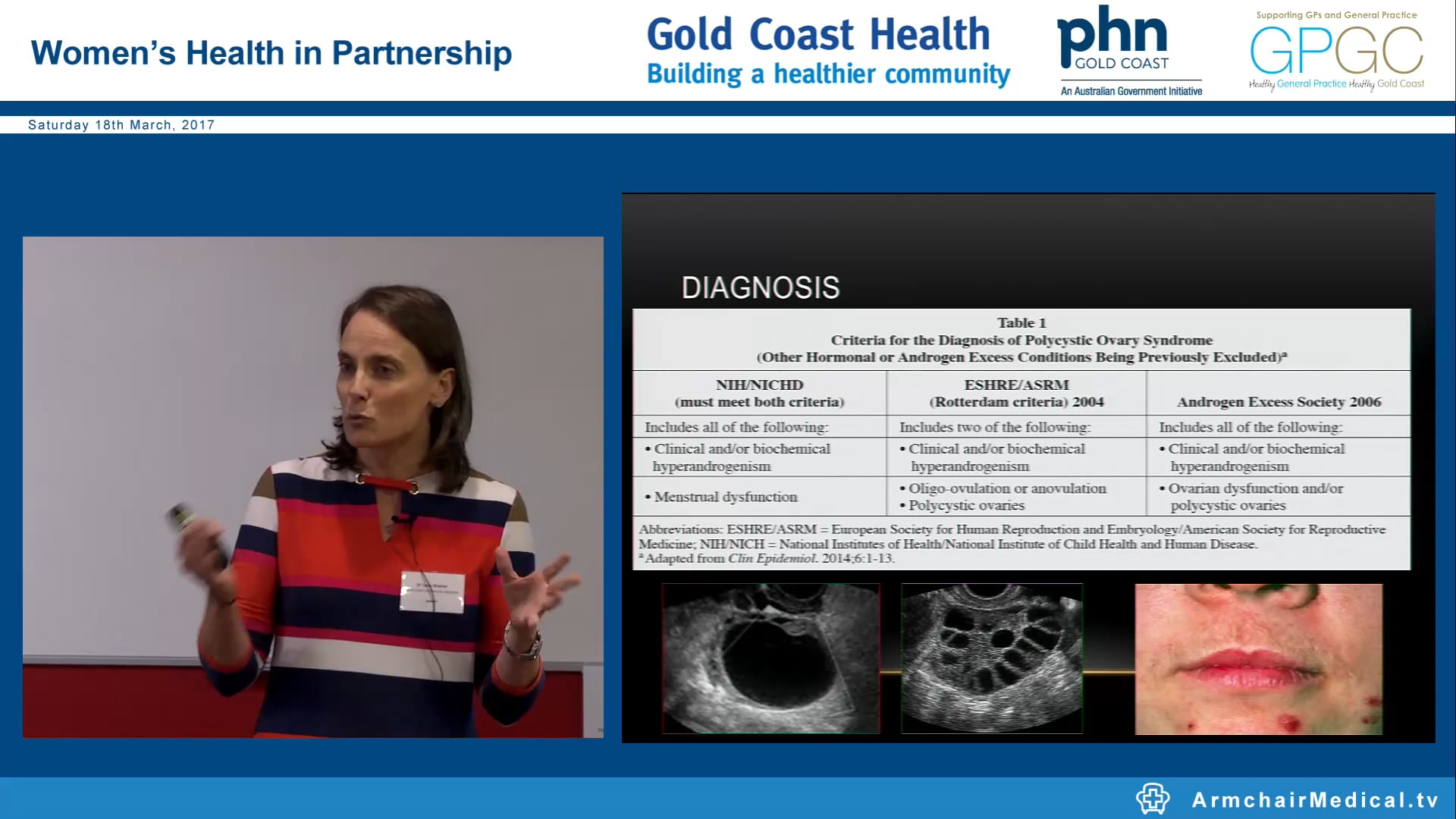 Polycystic Ovarian Syndrome Dr Tania Widmer