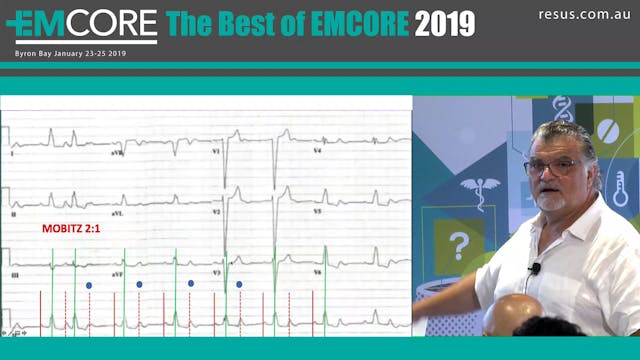 My favourite ECGs Can you get them As...