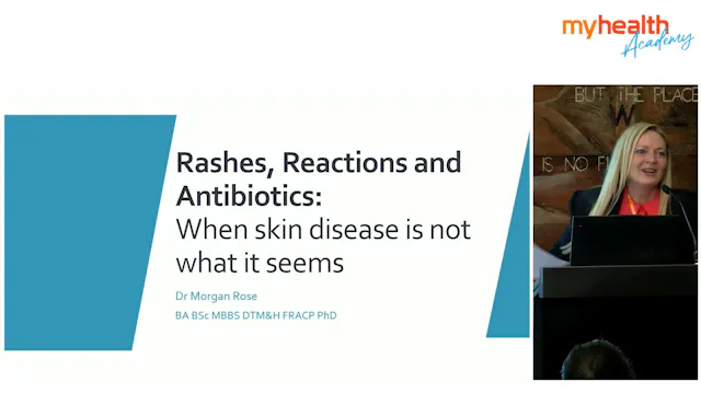 Rashes, Reactions & Antibiotics - Whe...