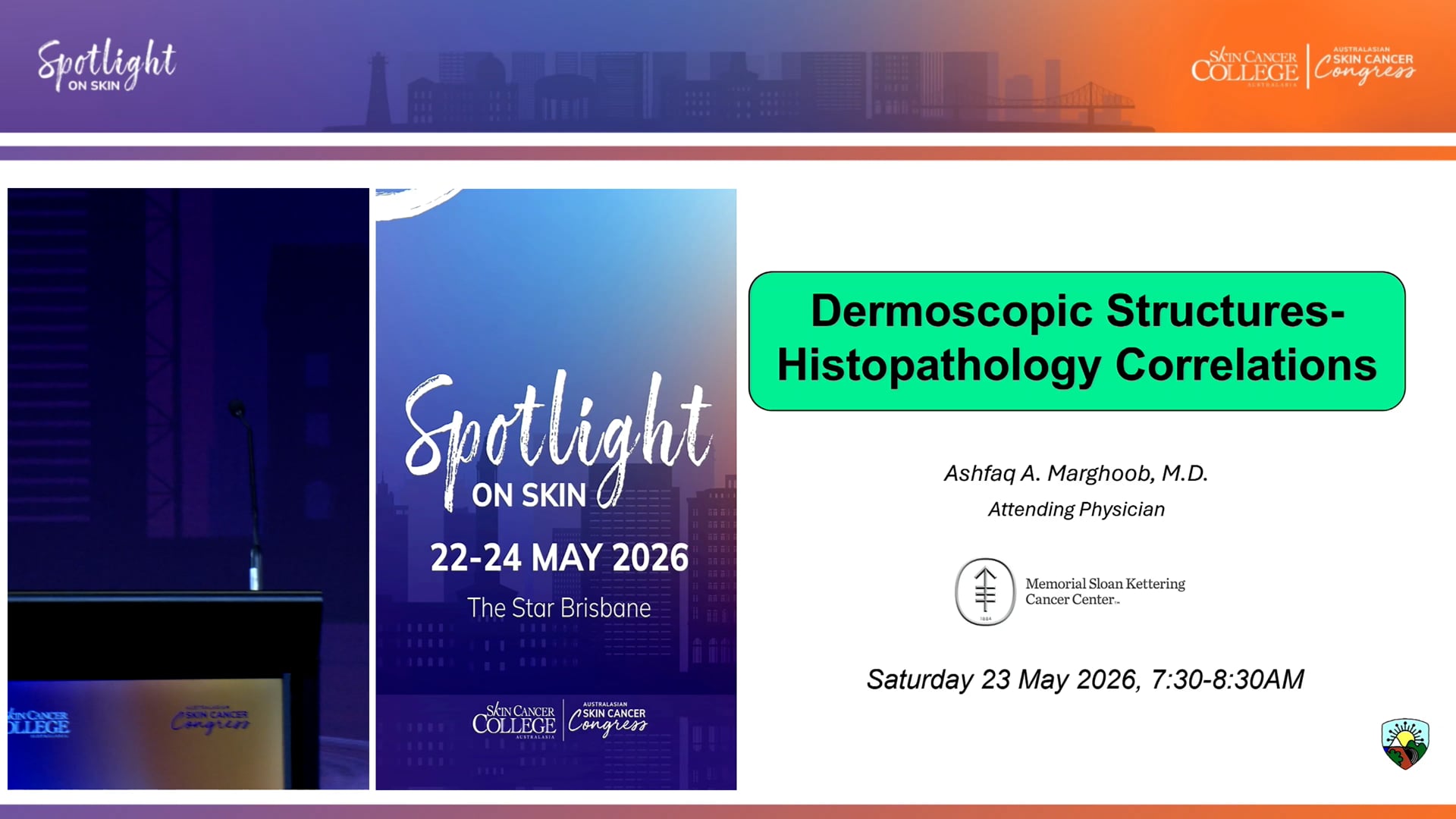 Dermatopathology Correlates for Common Benign Lesions, KCs and Melanoma Dr Ashfaq Marghoob