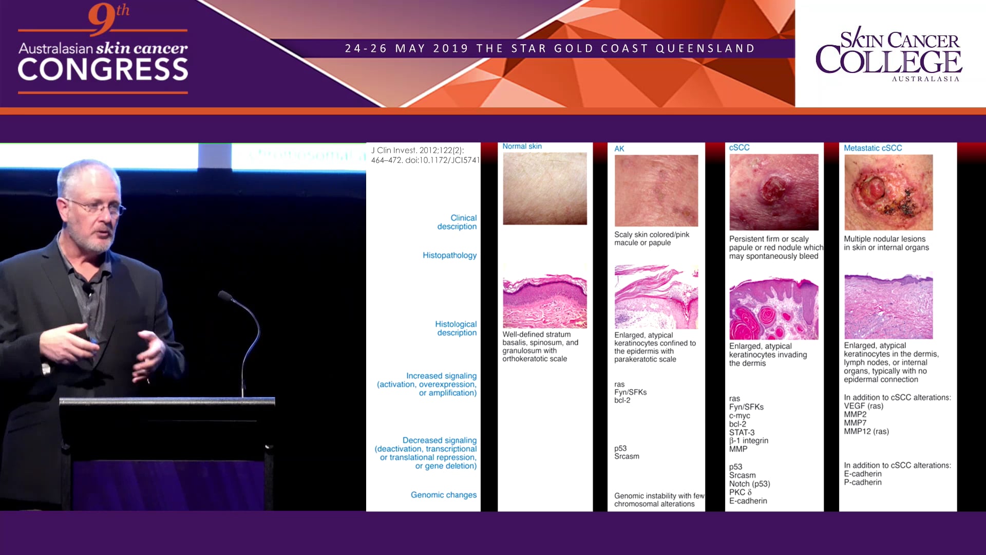 PDT Evolution & Cryotherapy - getting it right Dr Franz Strydom