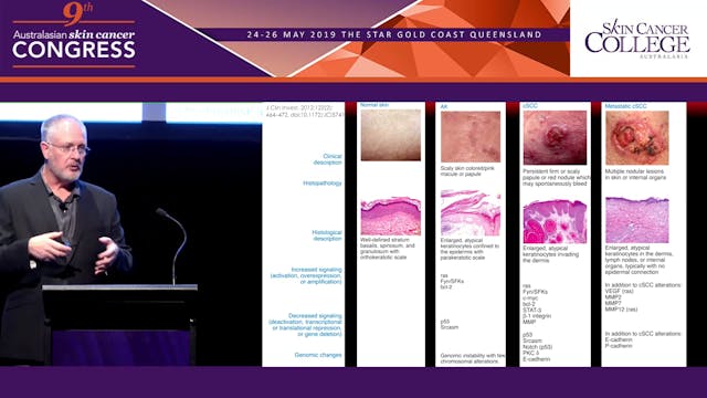 PDT Evolution & Cryotherapy - getting...