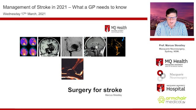 Surgery for stroke Professor Marcus Stoodley