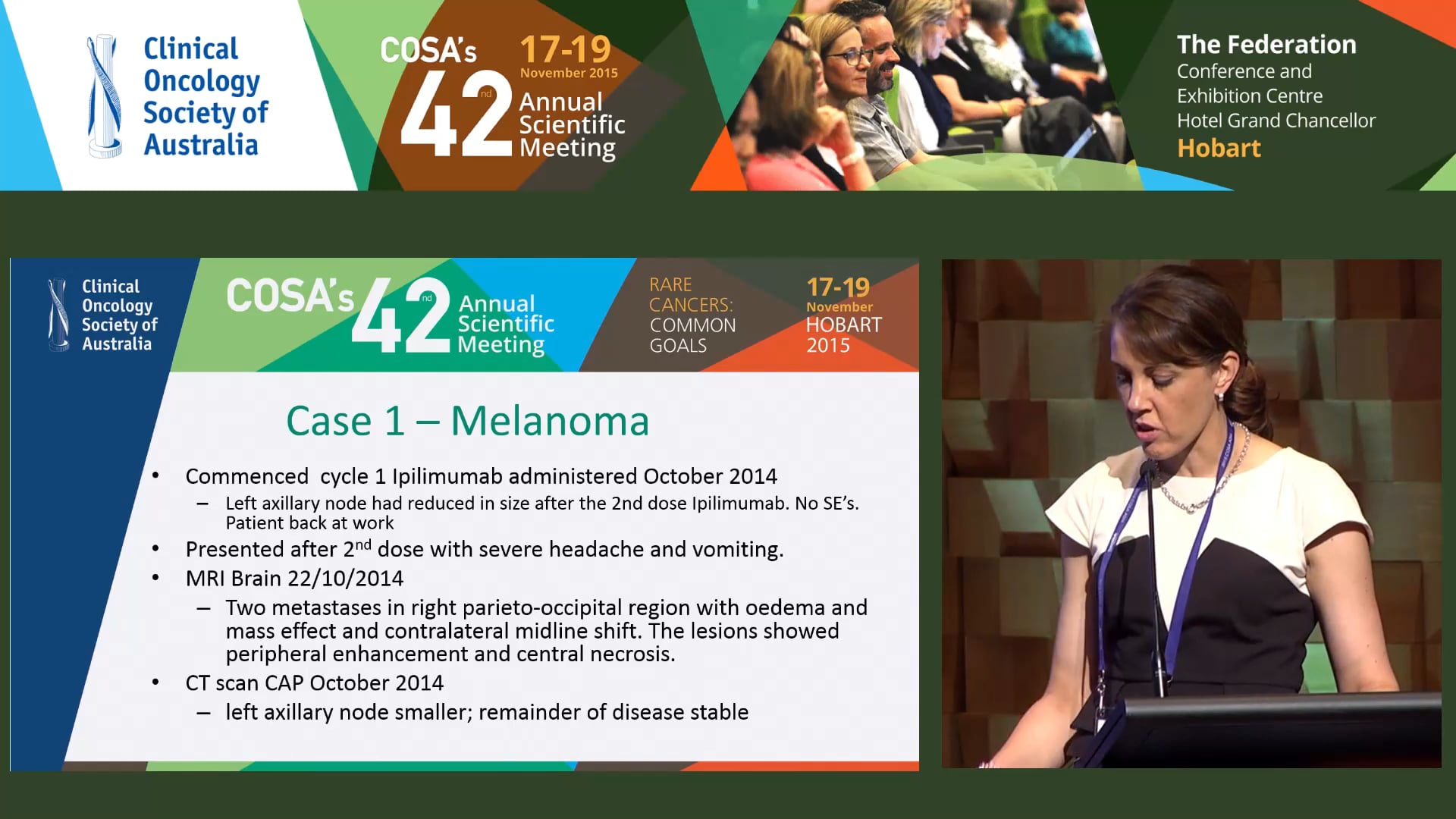Brain Teasers - Cerebral Metastasis and the MDT Case 1