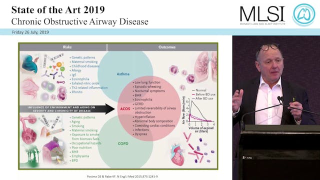 Treatment of COPD The Future Prof Kla...