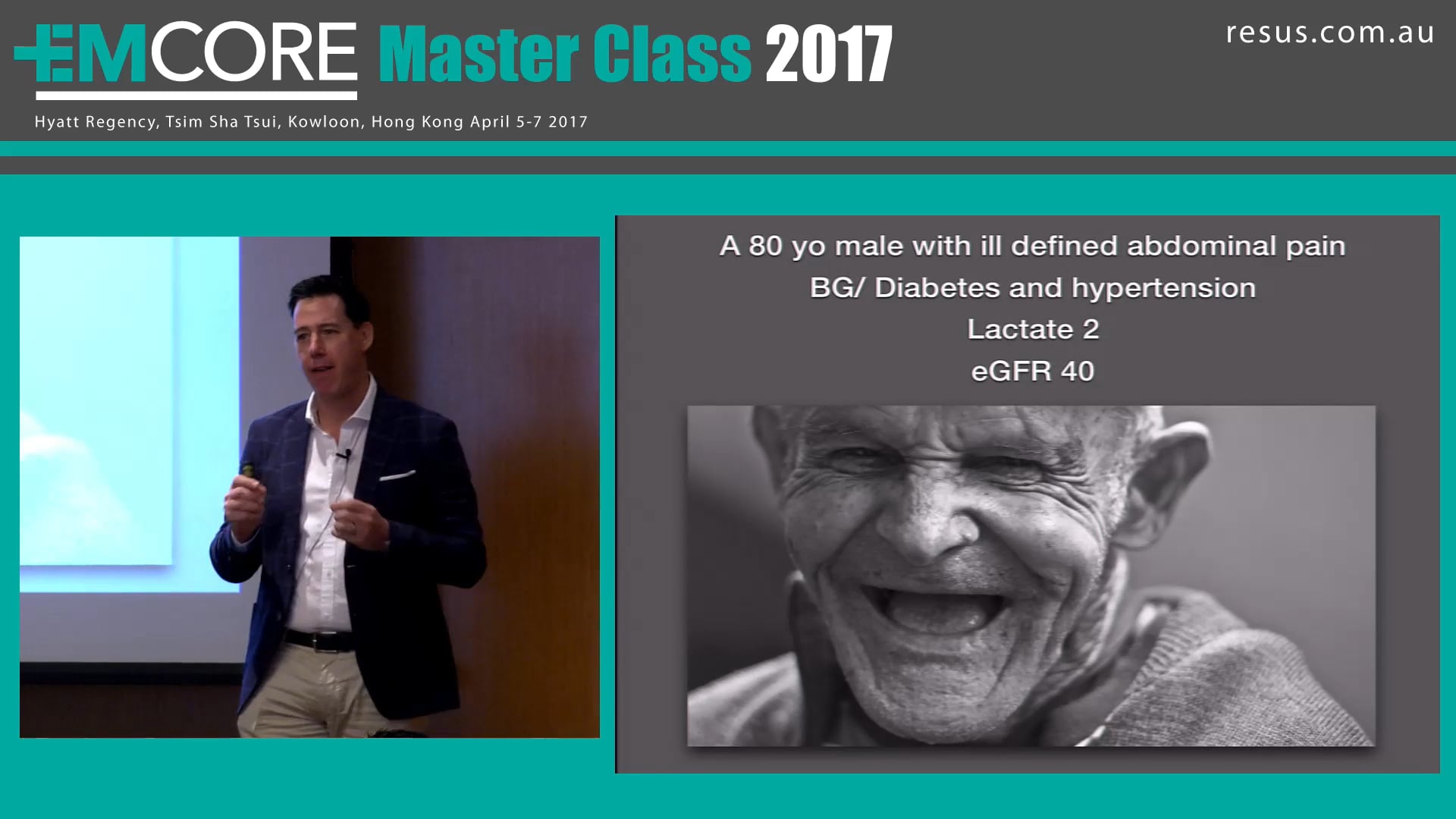 Contrast induced nephropathy Is it real Dr James Edwards