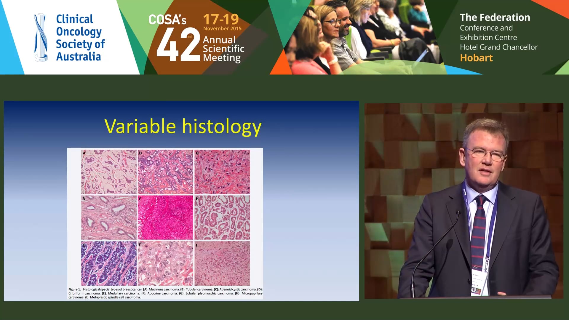 Bruce Mann Rare subtypes of breast cancer