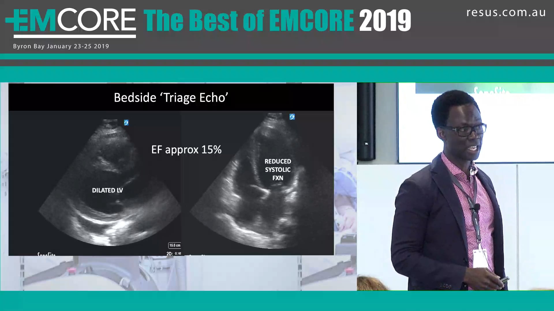 Asthmatic with 3 weeks of SOB Hansel Addae