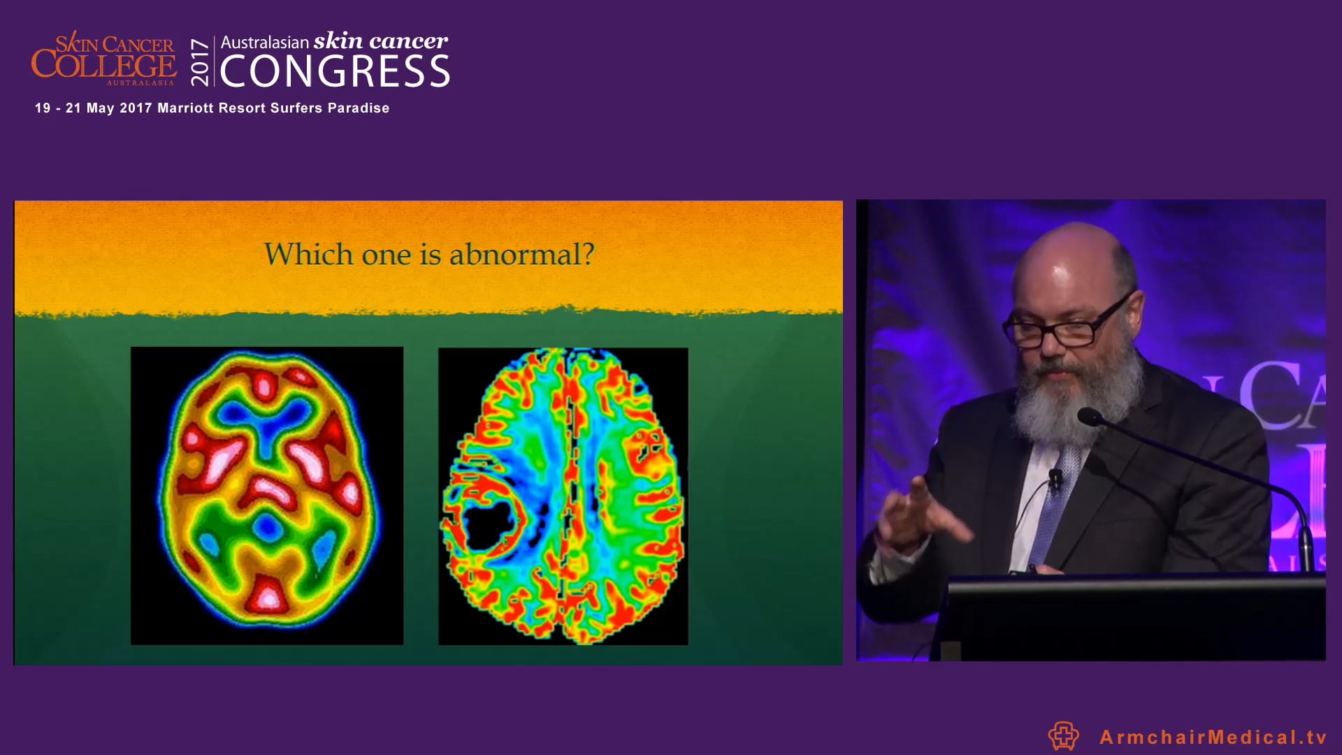 Dragon hunting Heuristic dermoscopy Dr Chris Wetherall