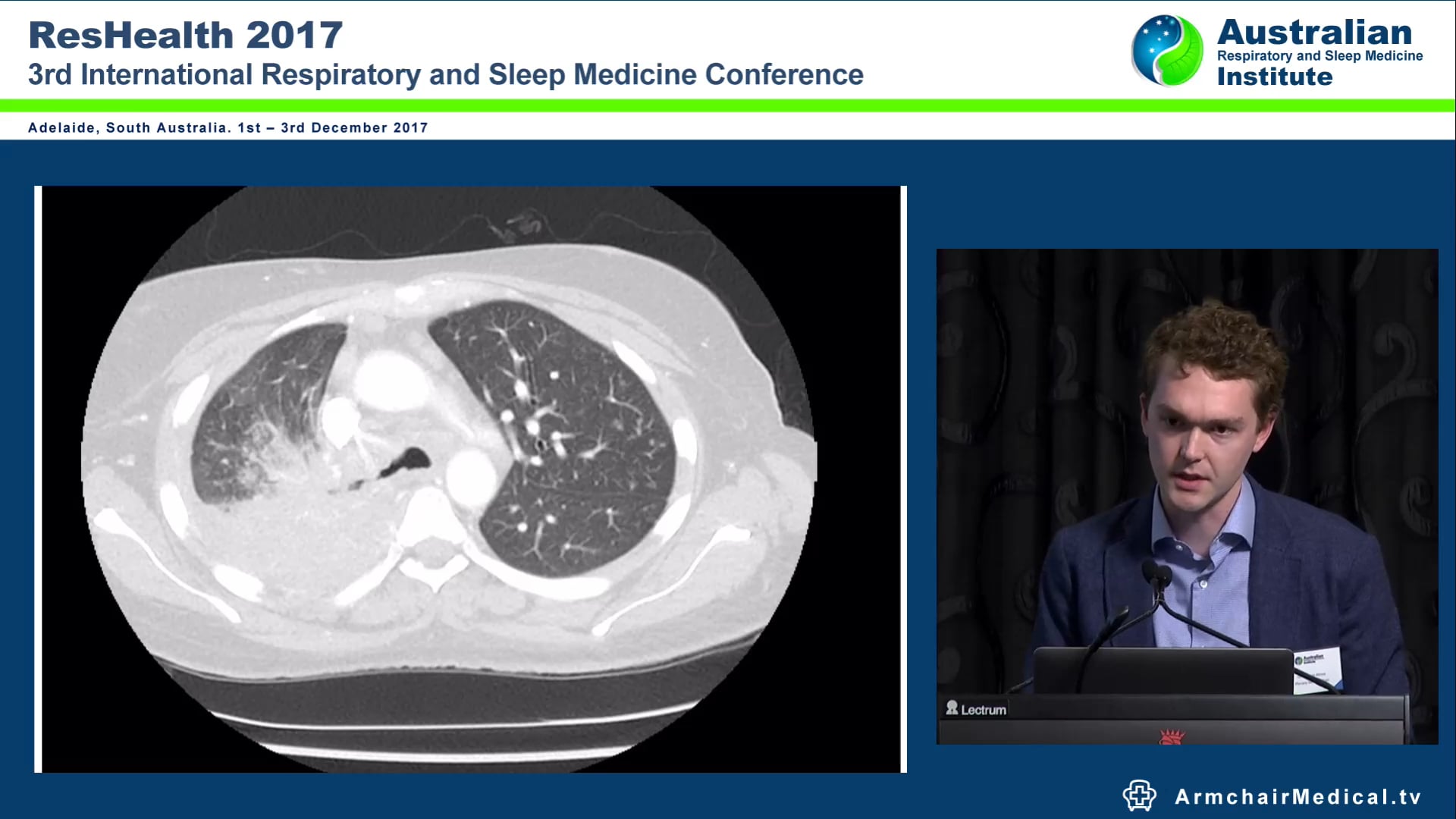 Case Breathtaking new Mac Dr Thomas Altree