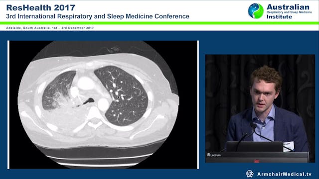 Case Breathtaking new Mac Dr Thomas A...