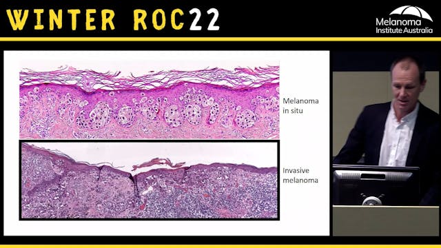 Understanding the pathology report Dr...