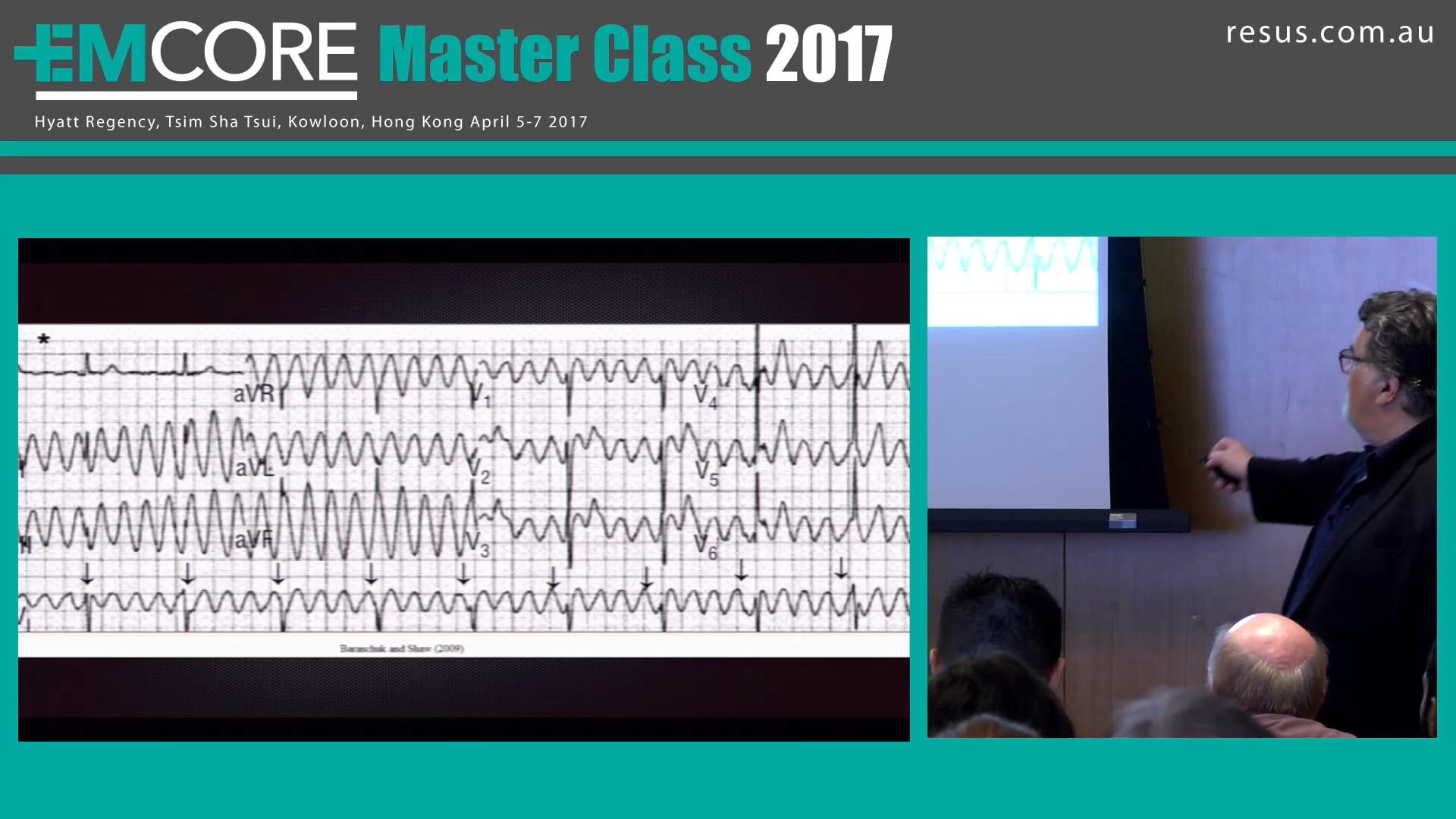 Arrhythmia of the apocalypse Assoc Prof Peter Kas