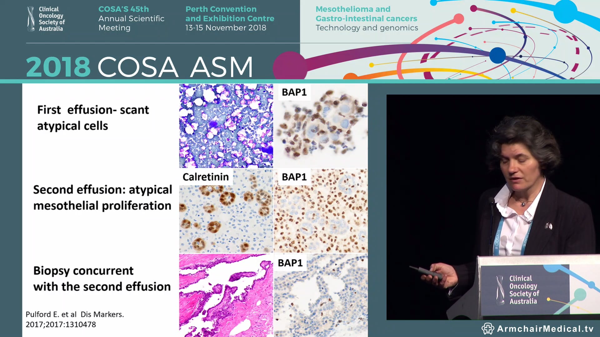 Controversies in mesothelioma Biposy or cytological diagnosis Sonja Klebe & Amanda Segal