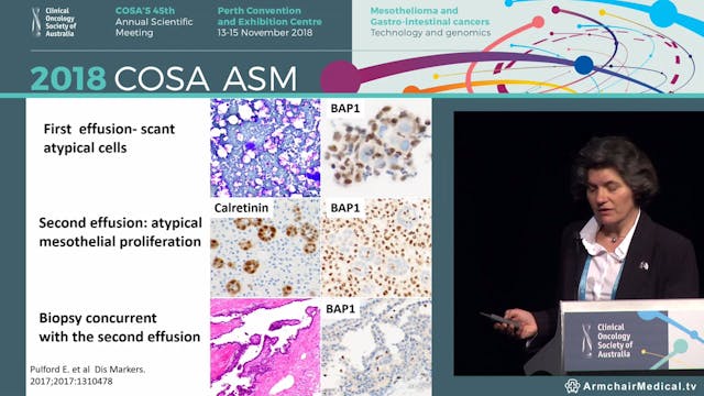Controversies in mesothelioma Biposy ...