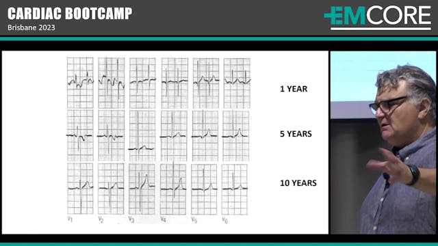 Paediatric ECG Assoc Peter Kas