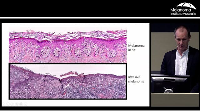 Understanding the pathology report Dr...