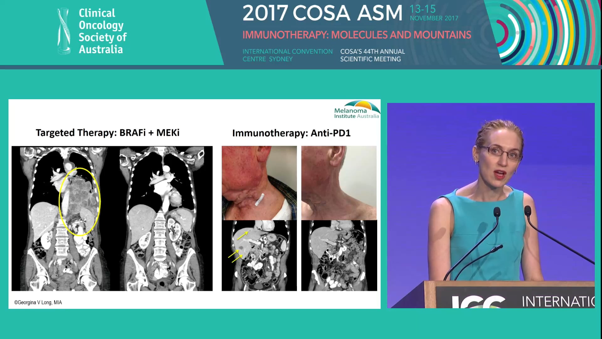 Predicating response and resistance in drug therapy for advanced melanoma Prof Georgina Long
