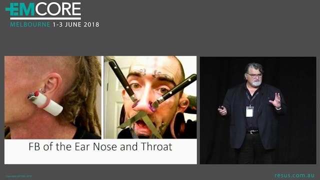 Foreigh body of Ear Nose and throat A...