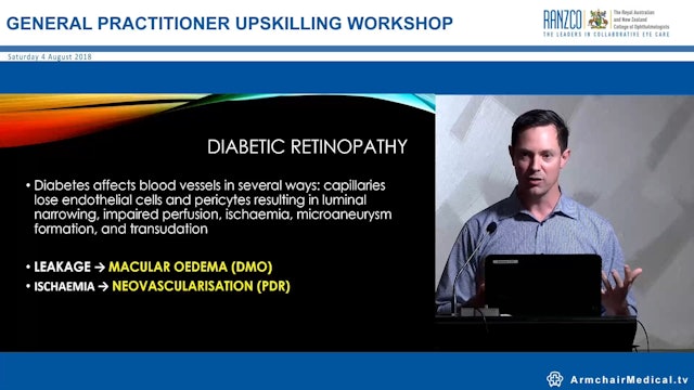 Advances in the treatment of diabetic retinopathy Dr Nathan Walker