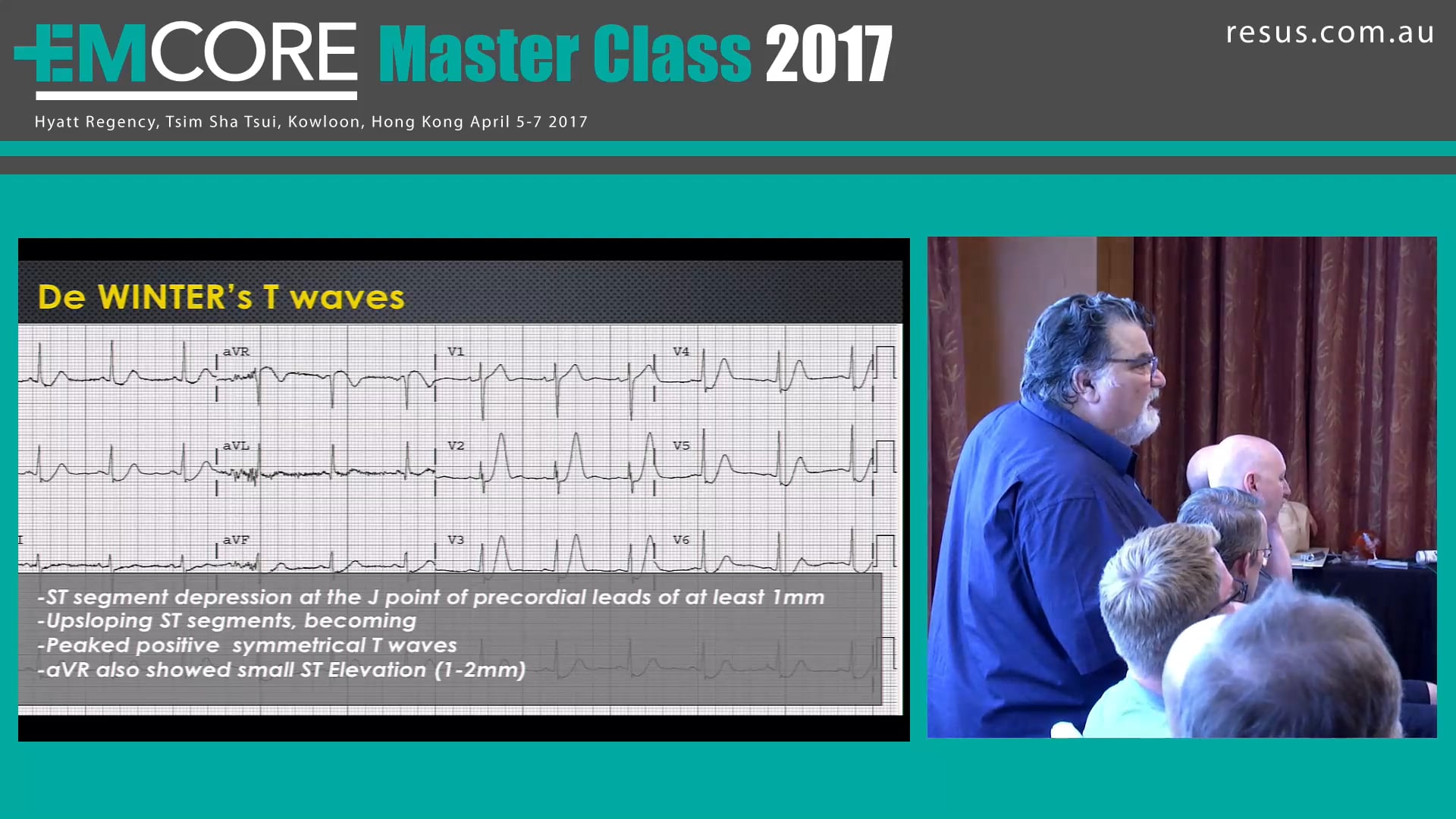 Brugada, Wellens, Dewinters, Spodick Assoc Prof Peter Kas