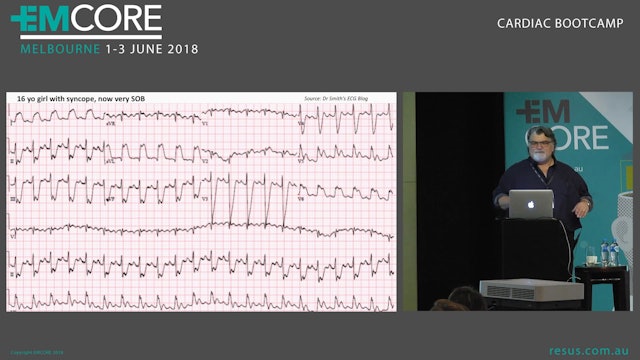 Paediatric heart conditions and Paediatric ECG Assoc Prof Peter Kas