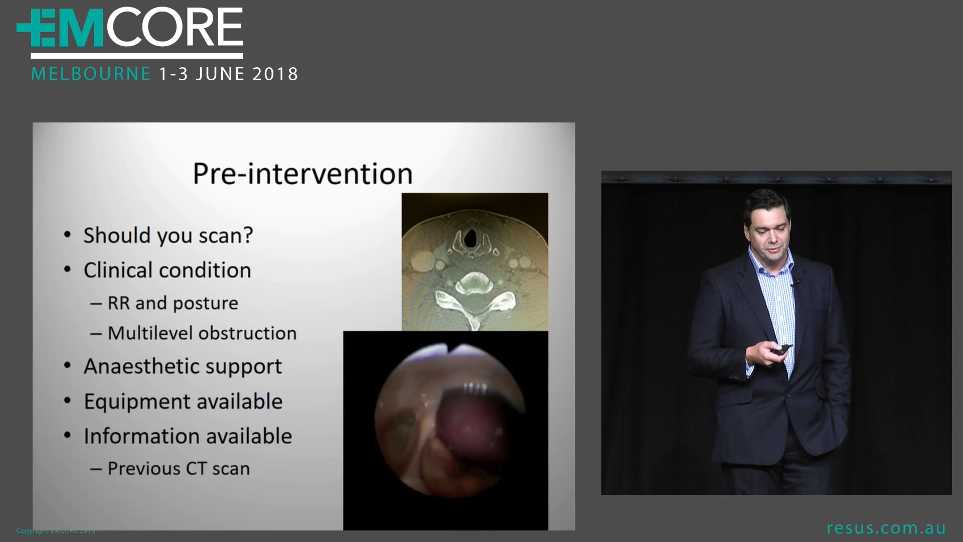 The surgical airway and ENT perspective Dr Charles Giddings