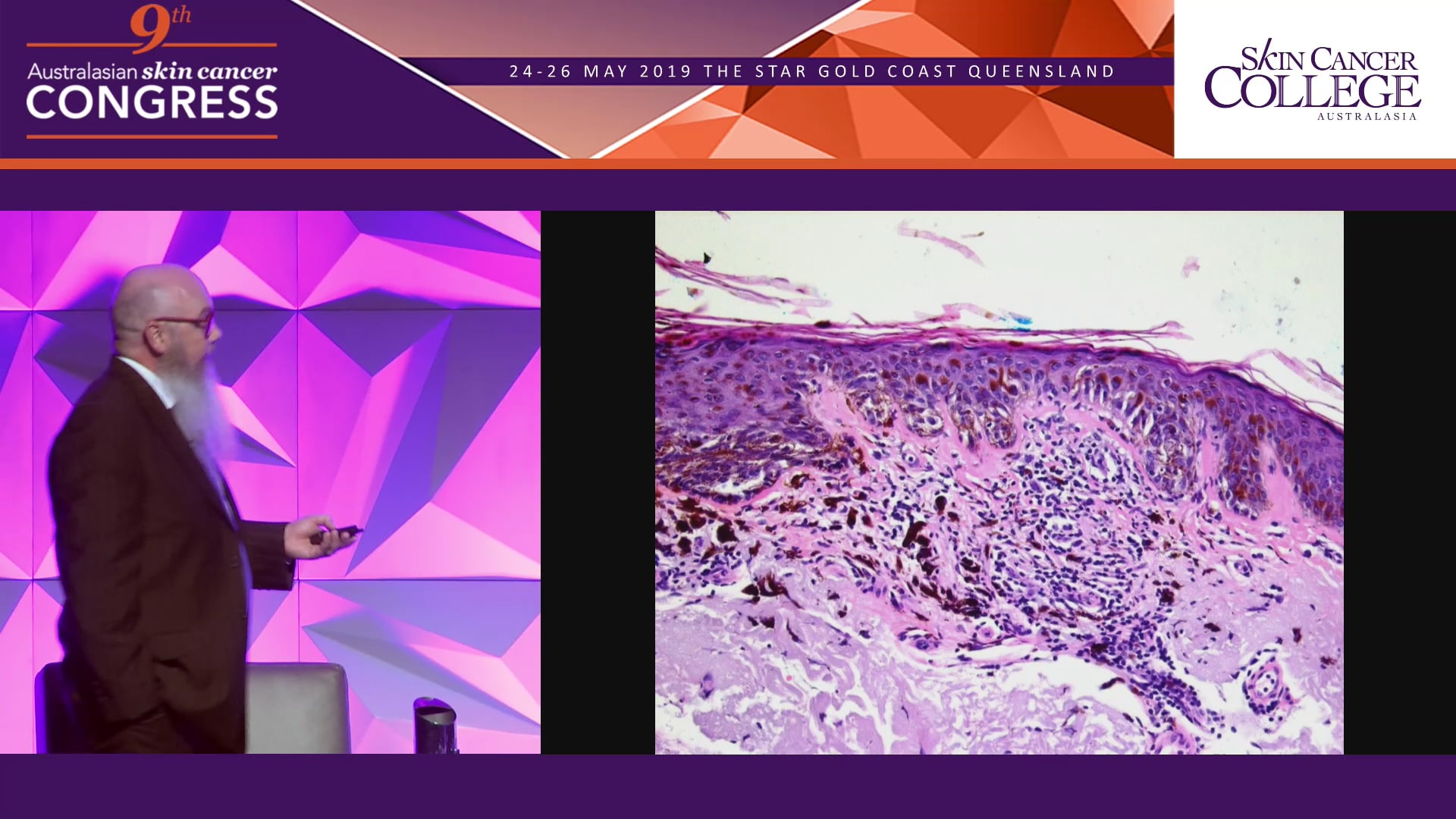 Histopathology for the practicing dermoscopist Dr Chris Wetherall