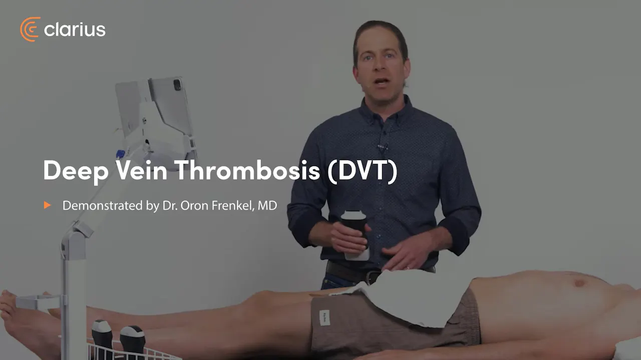 Deep Vein Thrombosis (DVT) - Ultrasound Scanning Technique ...
