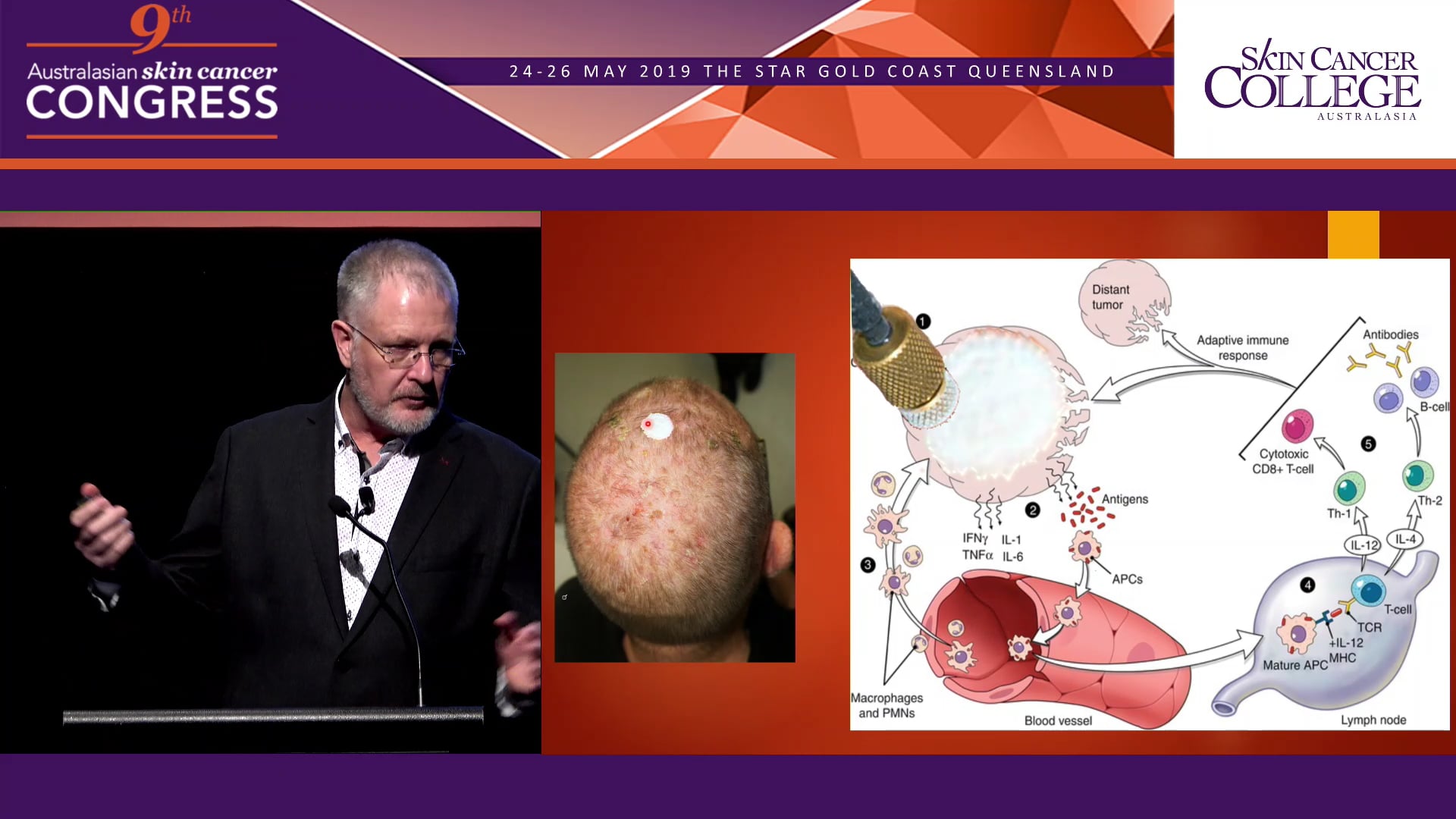 PDT Basics & Improving the outcome of topical treatments Dr Franz Strydom