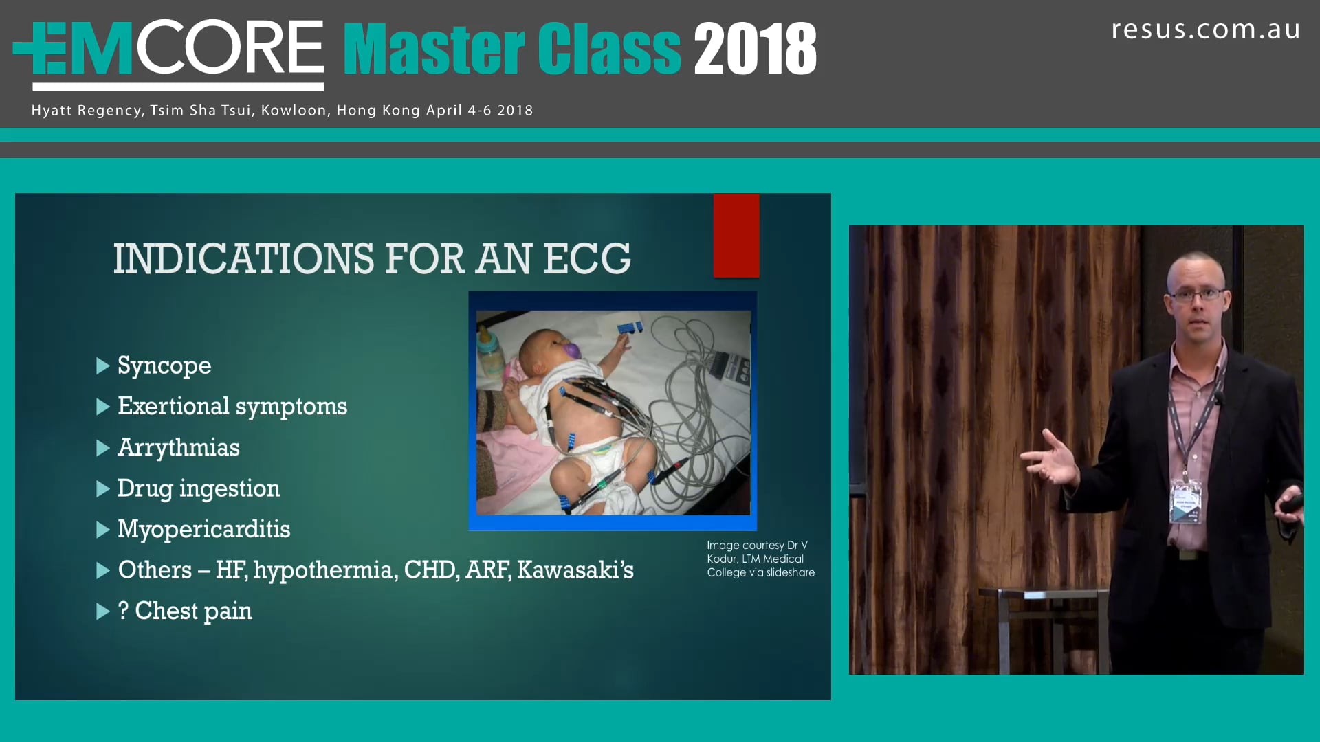 The Paediatric ECG Dr Adam Michaels