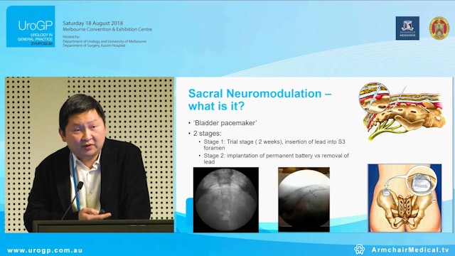 Sacral Neuromodulation for incontinence, Dr Johan Gani