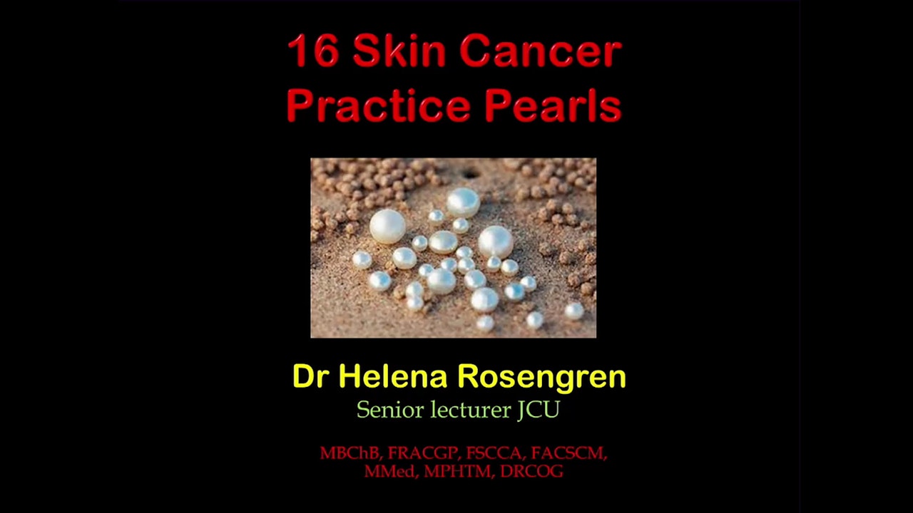 16 Skin Cancer Practice Pearls