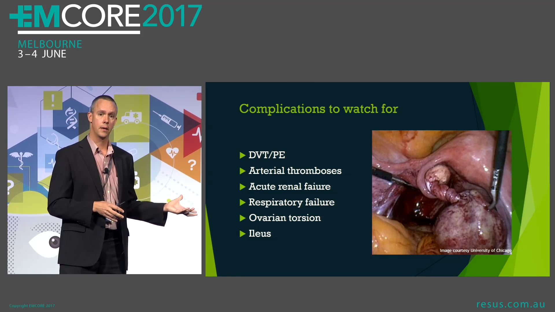 Is it ovarian hyperstimulation Dr Adam Michael Emergency Physician