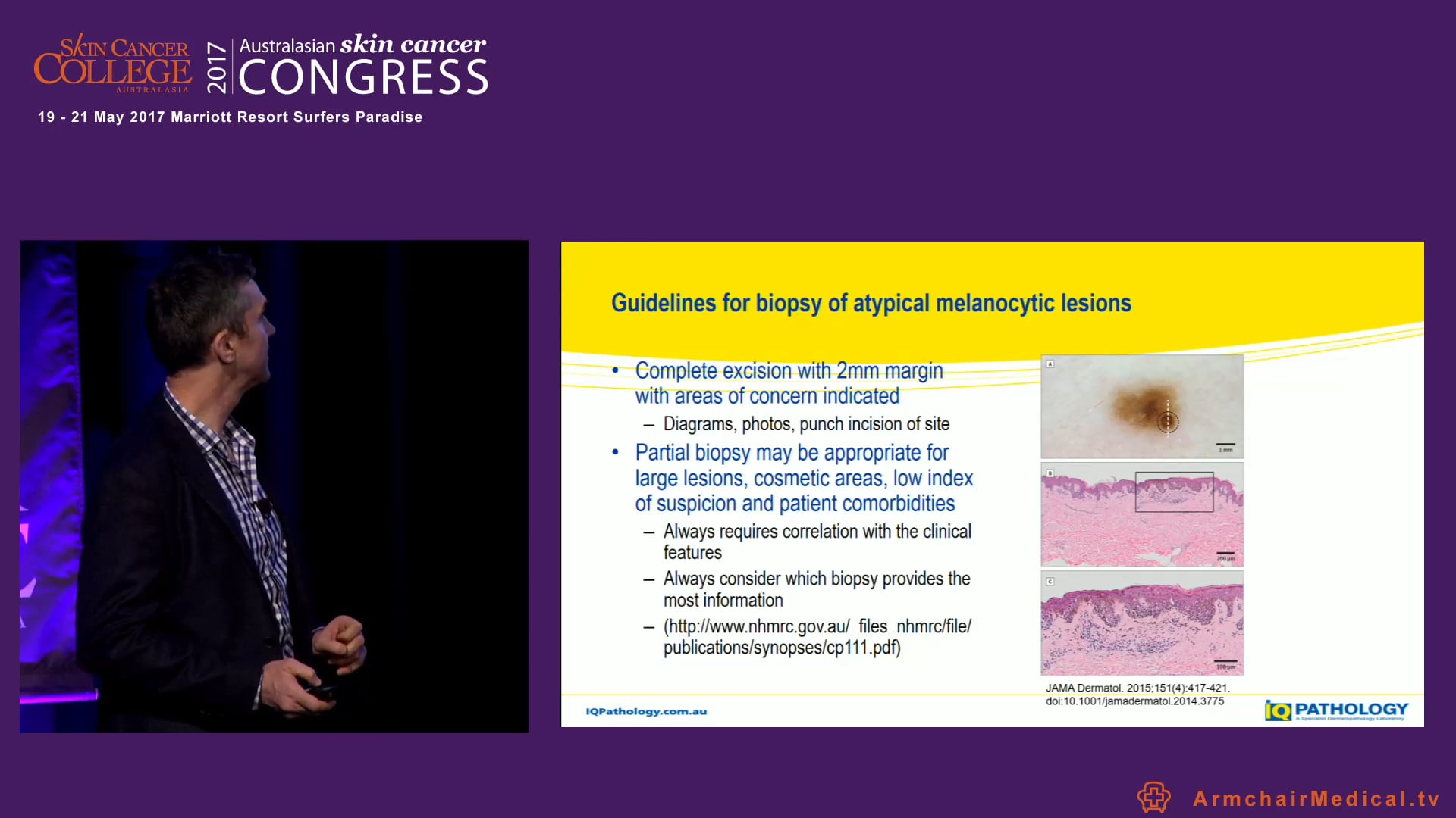 Biopsy and excision of melanocytic lesions Not drowning, wavin Dr Duncan Lambie