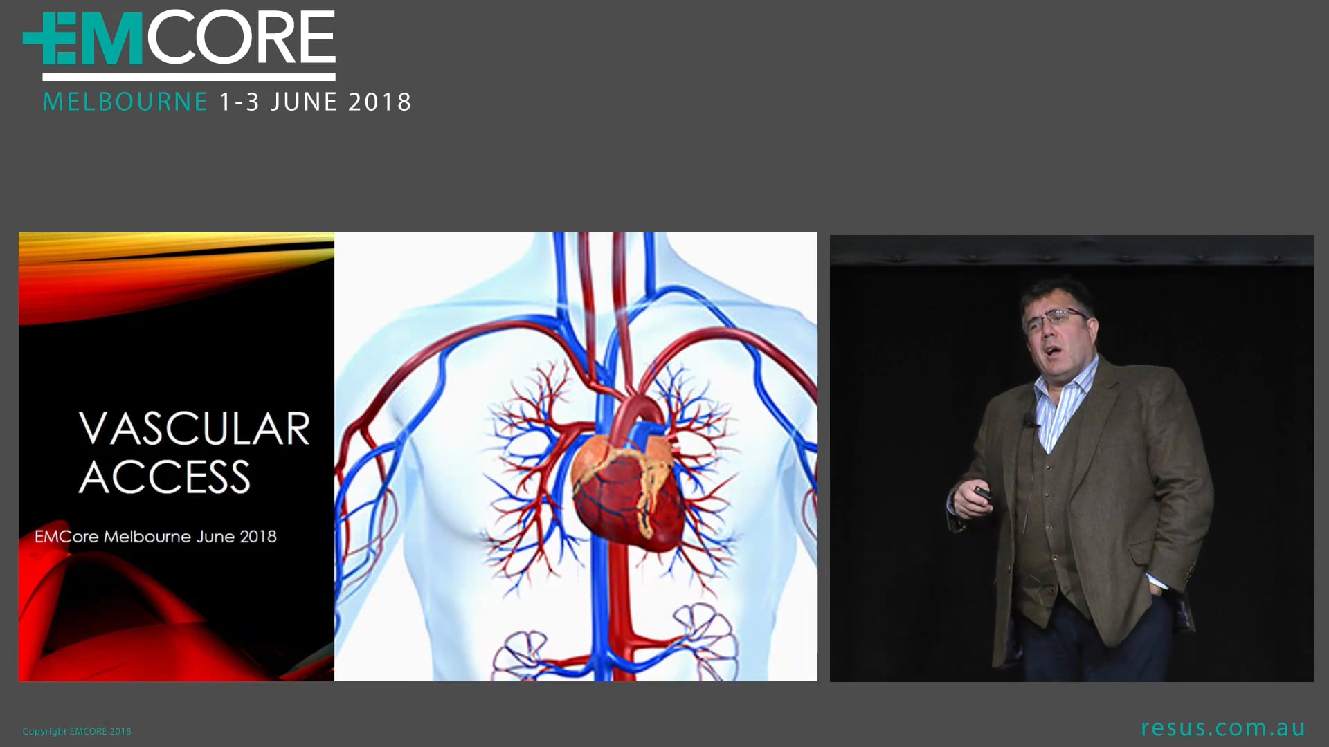 Vascular access Dr Will Davies