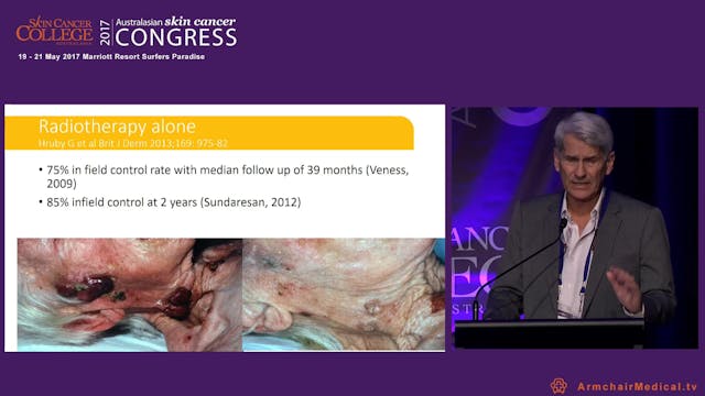 Merkel cell carcinoma of skin A rare ...