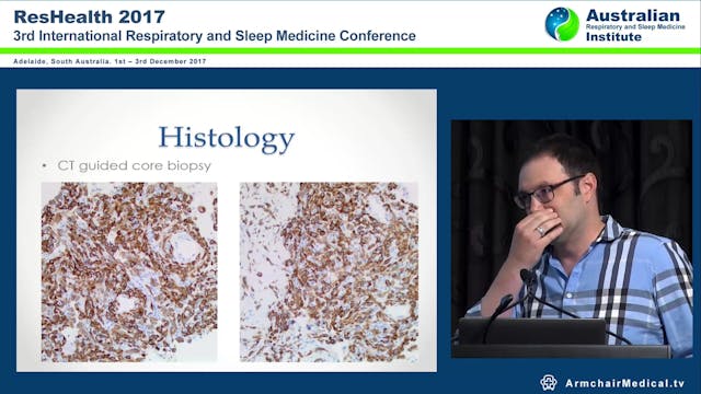 Case Rapidly Progressive Lung Disease...