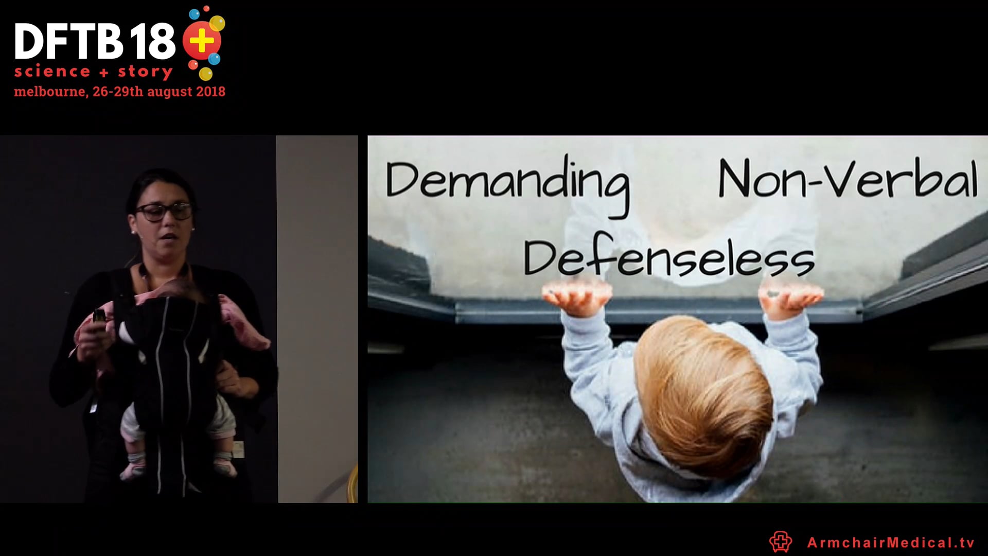 Non-accidental long bone injuries Nikki Abela