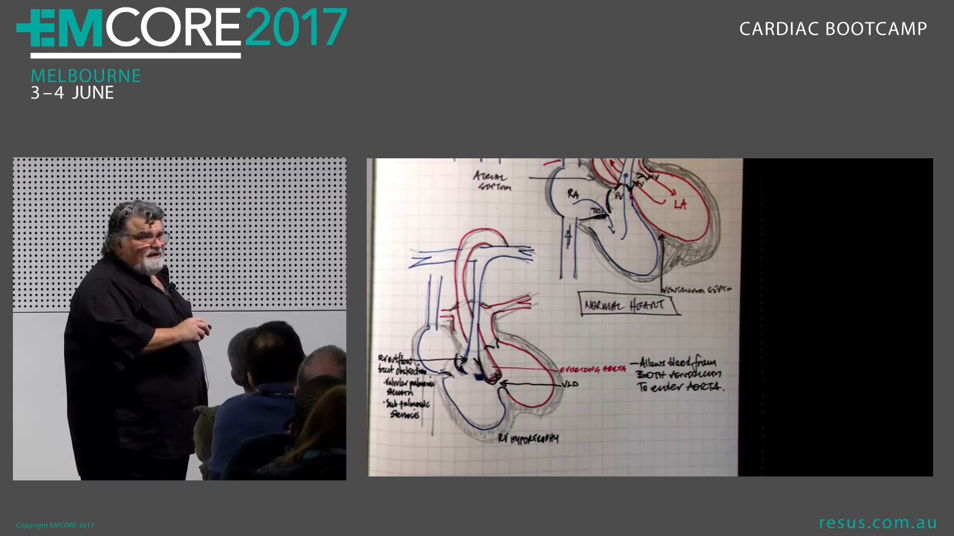 Paediatric Heart Conditions Assoc Prof Peter Kas