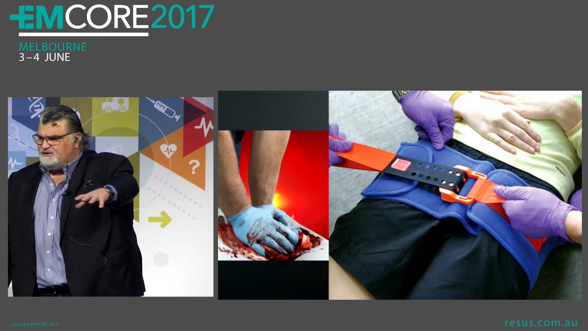 Trauma resuscitation Assoc Prof Peter Kas