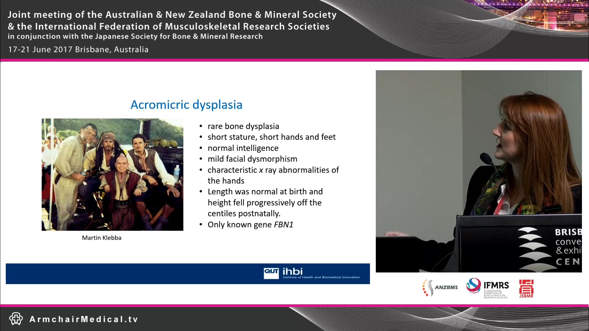 Genetic investigation of monogenic bone disease using whole exome sequencing Dr Aideen McInerney-Leo