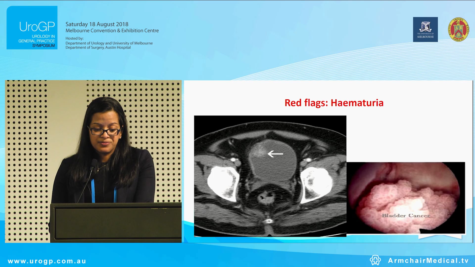 Medications You can Prescribe for Incontinence Pharmacotherapy for overactive bladder, Dr Jos Jayarajan