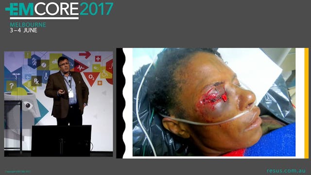 Ocular Trauma Dr Will Davies Emergenc...